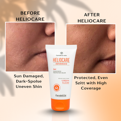 Heliocare Gel Sunscreen - Buy 1 Get 1 Free